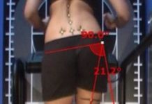 The role of Glutes in Patellofemoral Pain