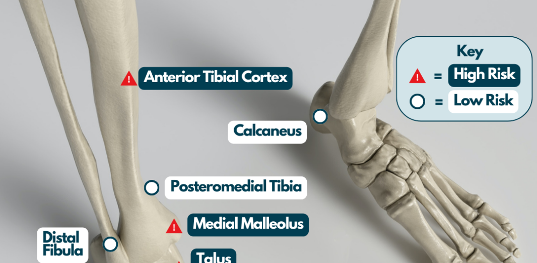 Foot and ankle - RunningPhysio
