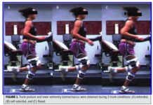 Will leaning forward help my runner's knee?