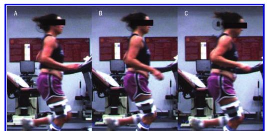 Will leaning forward help my runner’s knee? Will leaning forward help my runner's knee?