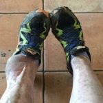50 surgeries and still running, Sam’s amazing story