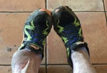50 surgeries and still running, Sam’s amazing story