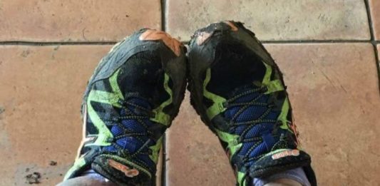 50 surgeries and still running, Sam’s amazing story