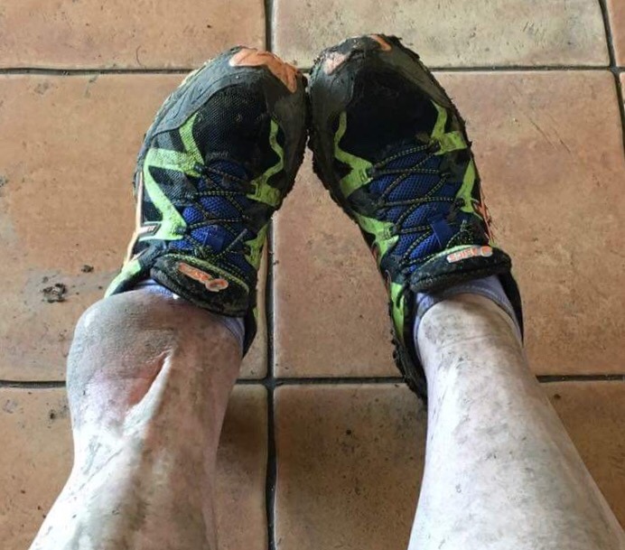 50 surgeries and still running, Sam’s amazing story