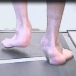 Segmentation: The scourge of running footwear industry