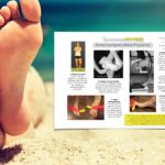 Exercise selection for Plantar Fasciopathy