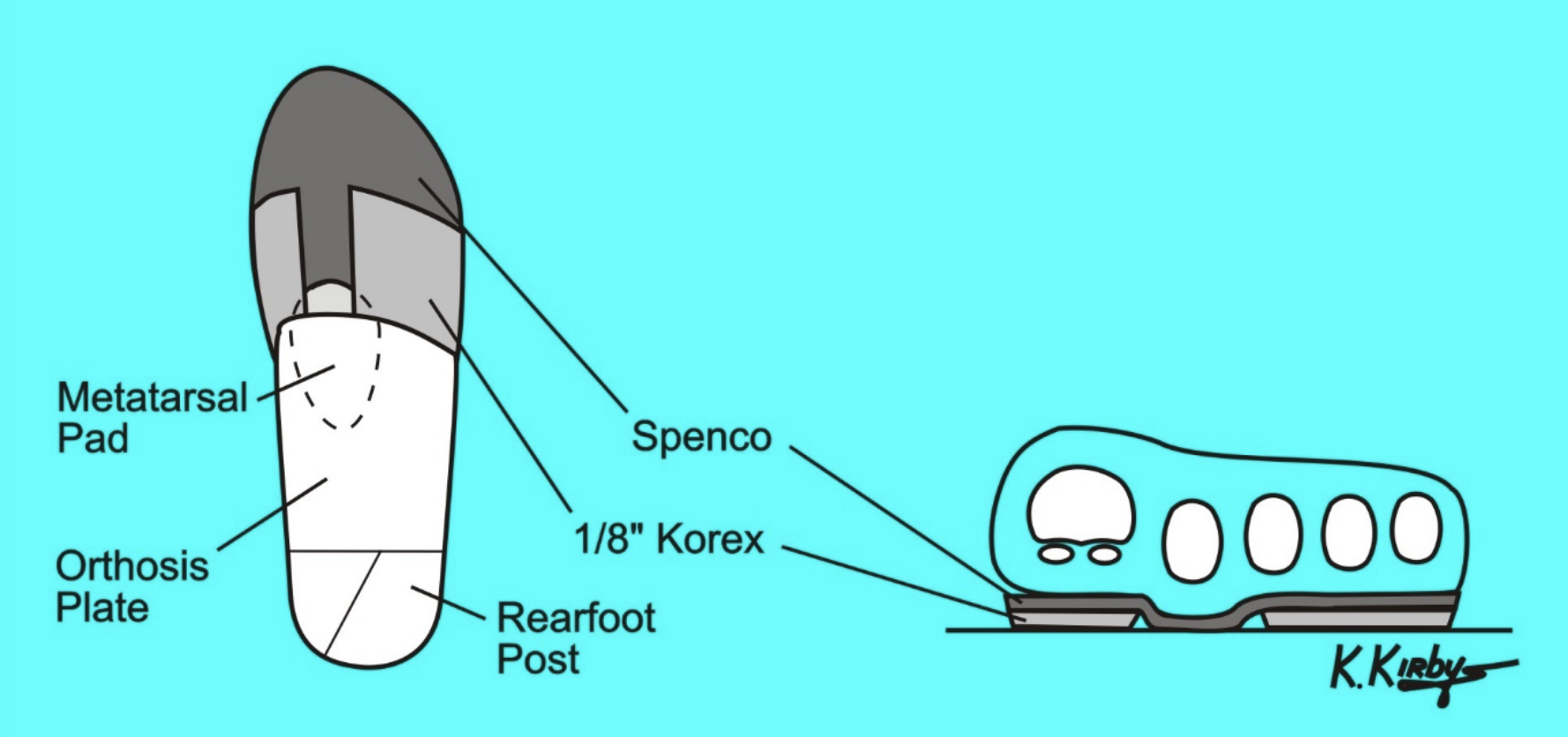 Plantar Plate injury, assessment and management by Nick Knight