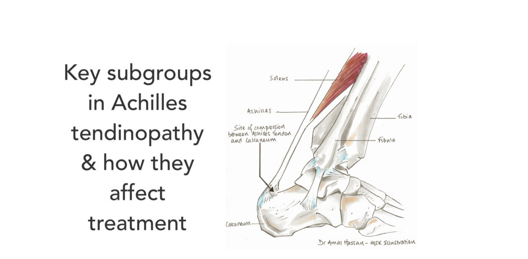 Tendinopathy RunningPhysio