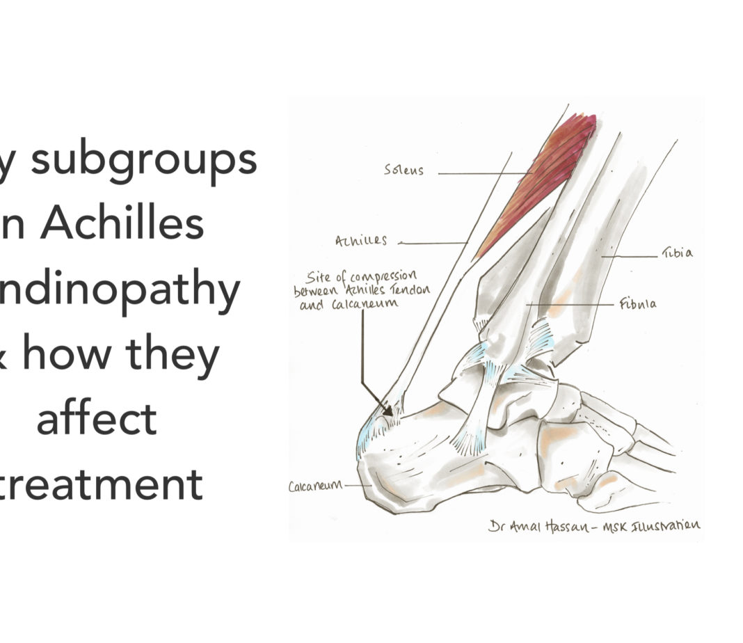 Tendinopathy RunningPhysio