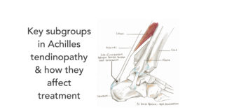 Key subgroups in Achilles tendinopathy and how they affect treatment
