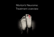 Morton's Neuroma