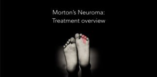 Morton's Neuroma