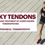 Tricky Tendons Part 2 - Peroneal pain, assessment and treatment