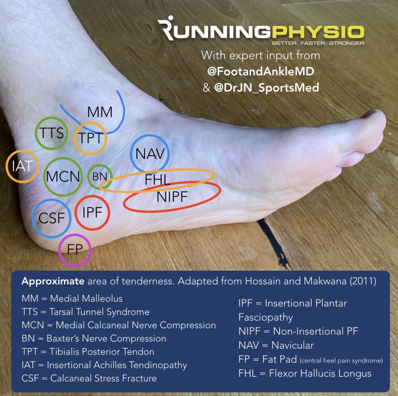 Exercise options for plantar heel pain RunningPhysio