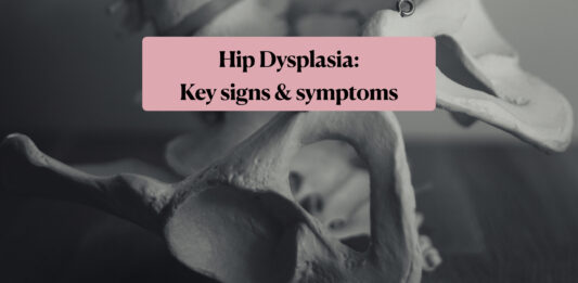 hip dysplasia